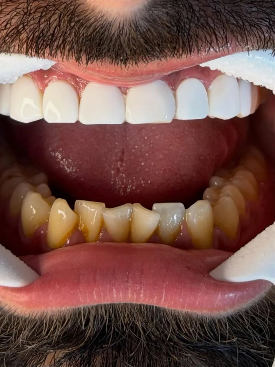 نمونه کامپوزیت دندادن رشت 2