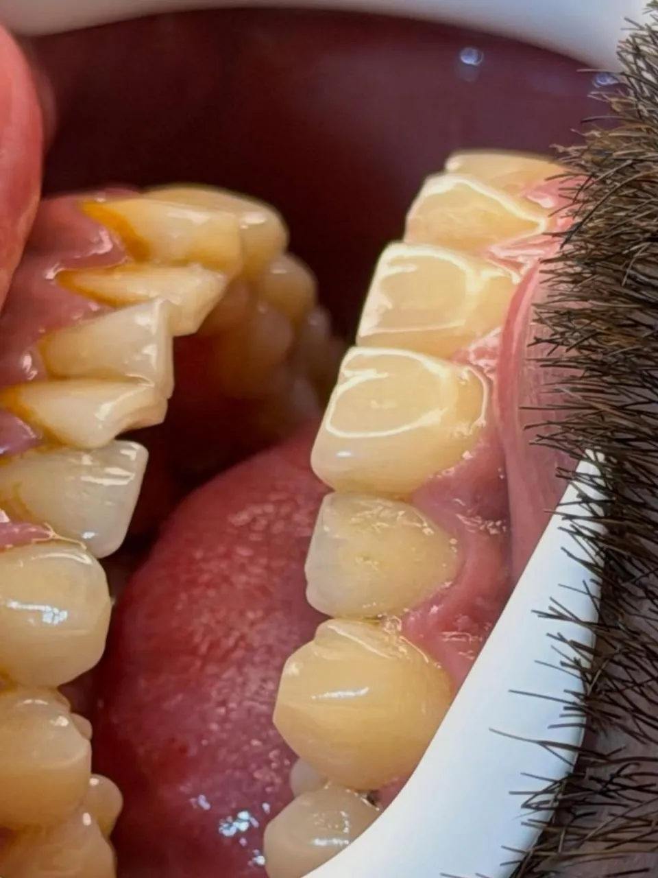 نمونه کامپوزیت دندادن رشت 6